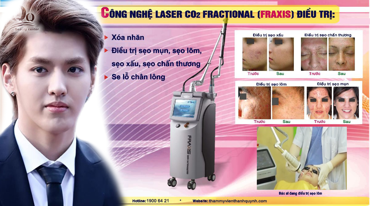 Công nghệ Laser trị thâm