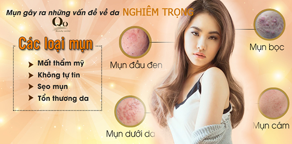 Các loại mụn  thường gặp trong điều trị 