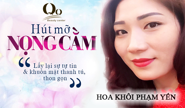 Giảm mỡ nọng cằm không phẫu thuật 