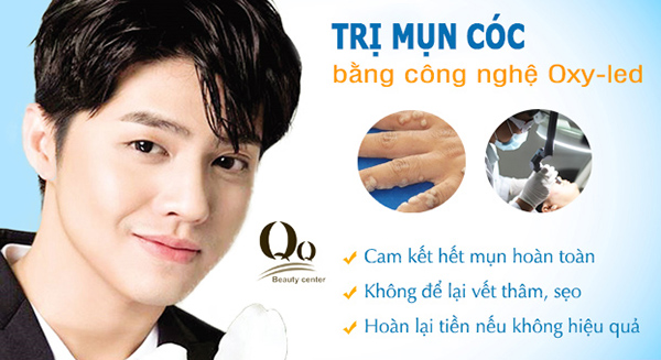 Trị mụn cóc tận gốc 