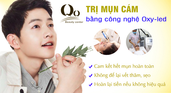 Điều trị mụn cám công nghệ OXY LED