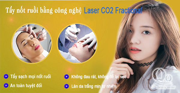 Tẩy nốt ruồi bằng Laser