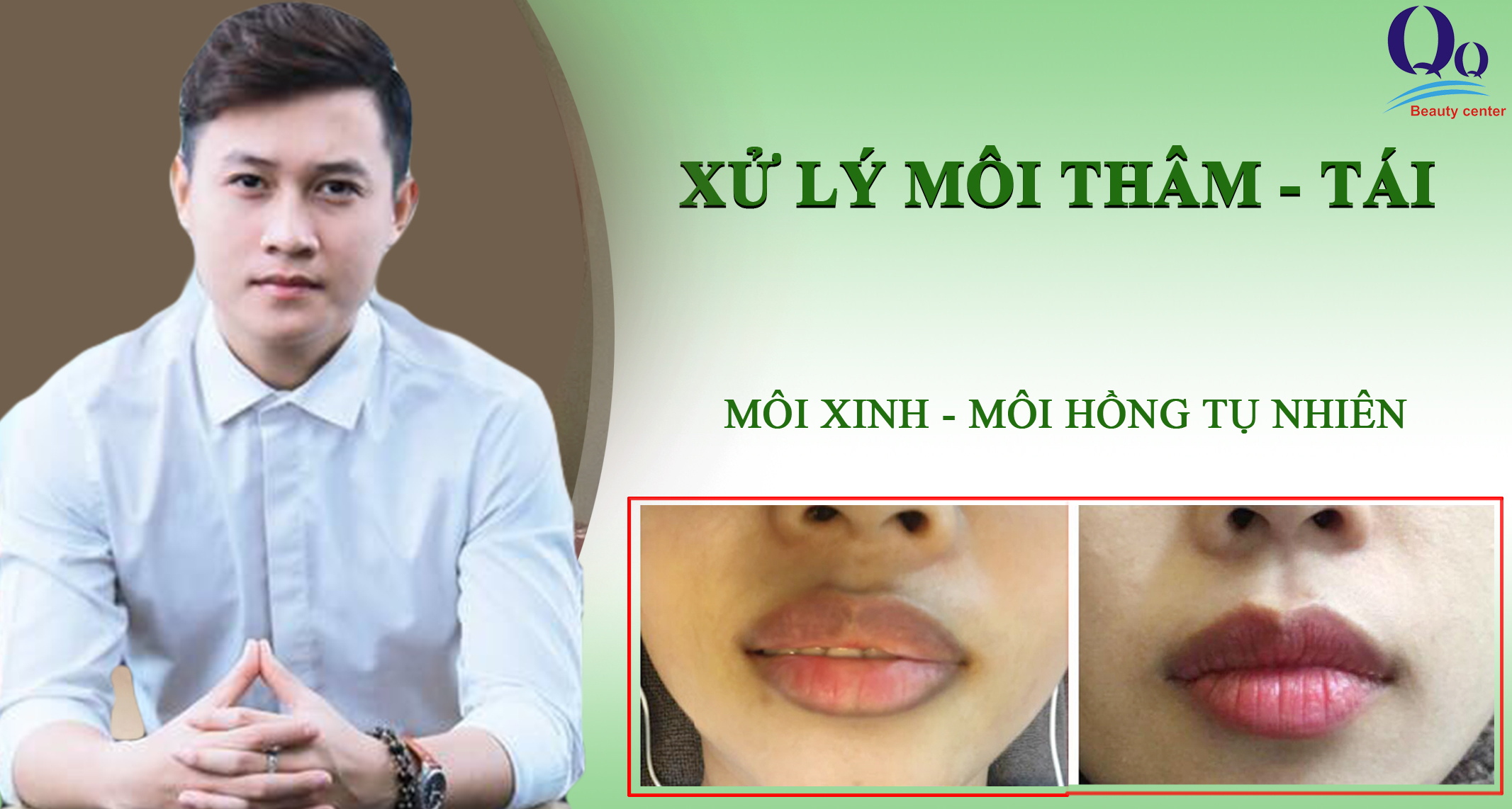  Xử lí môi thâm tái 