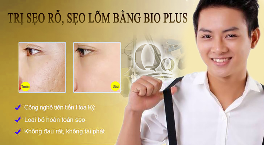 Trị sẹo lõm ,sẹo rỗ bằng Laser