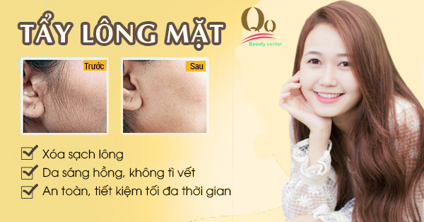 Triệt lông mặt vĩnh viễn